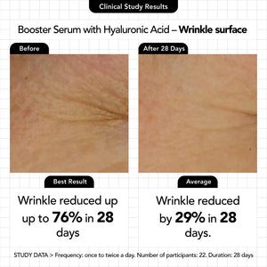 Booster Serum with Hyaluronic Acid (Travel Size) - Novexpert Malaysia Online