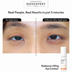 Radiance Lifting Eye Contour - Novexpert Malaysia Online