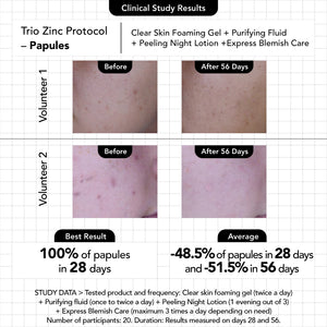 Clear Skin Foaming Gel - Novexpert Malaysia Online