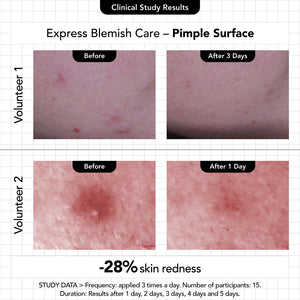 Express Blemish Care - Novexpert Malaysia Online