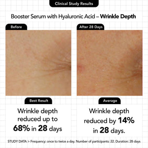 Booster Serum with Hyaluronic Acid (NEW!) - Novexpert Malaysia Online
