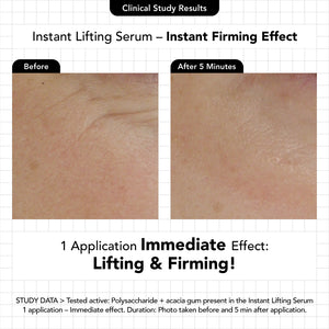The Instant Lifting Serum - Novexpert Malaysia Online