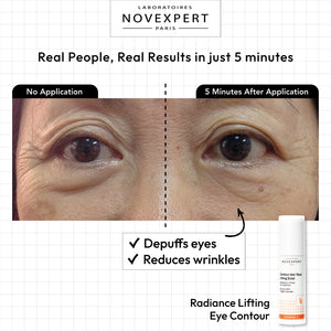 Radiance Lifting Eye Contour - Novexpert Malaysia Online