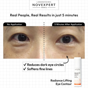 Radiance Lifting Eye Contour - Novexpert Malaysia Online