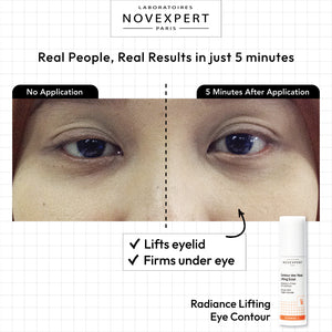 Radiance Lifting Eye Contour - Novexpert Malaysia Online