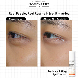 Radiance Lifting Eye Contour - Novexpert Malaysia Online