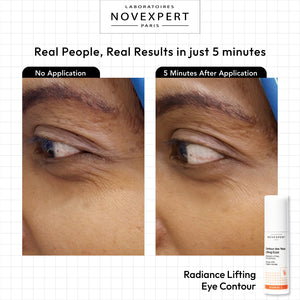 Radiance Lifting Eye Contour - Novexpert Malaysia Online