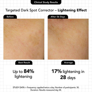 Targeted Dark-Spot Corrector - Novexpert Malaysia Online