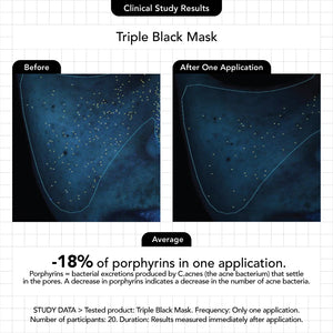 Triple Black Mask - Novexpert Malaysia Online